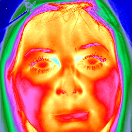 Avoid radiation with thermography