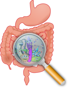 gut bacteria prevent or cause colorectal cancer healitall.com